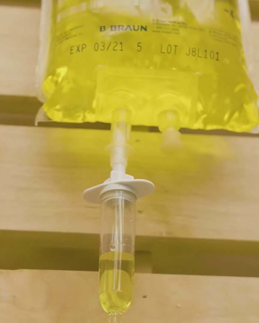 mobile-iv-therapy-tempe-az IV Fluids for Hydration